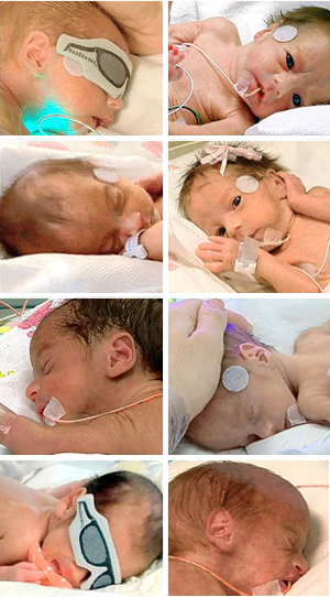 octuplets-pictures-video